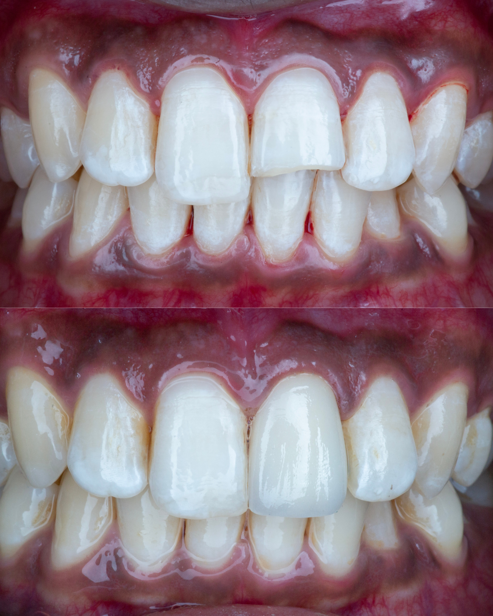 Case4