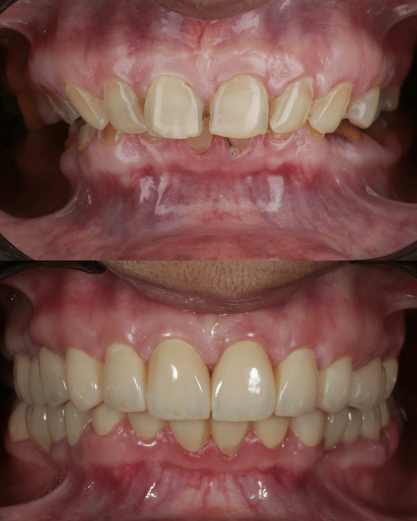 CASE5