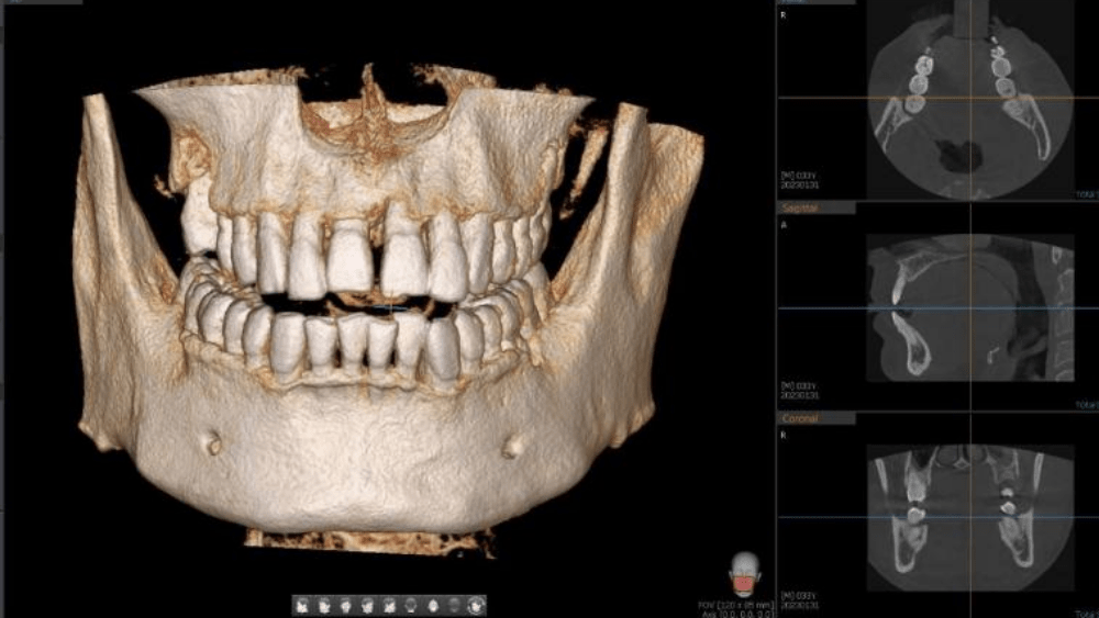 “3D dental scans and photographs used to assess teeth, gums and bone health